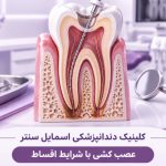 قیمت عصب کشی دندان