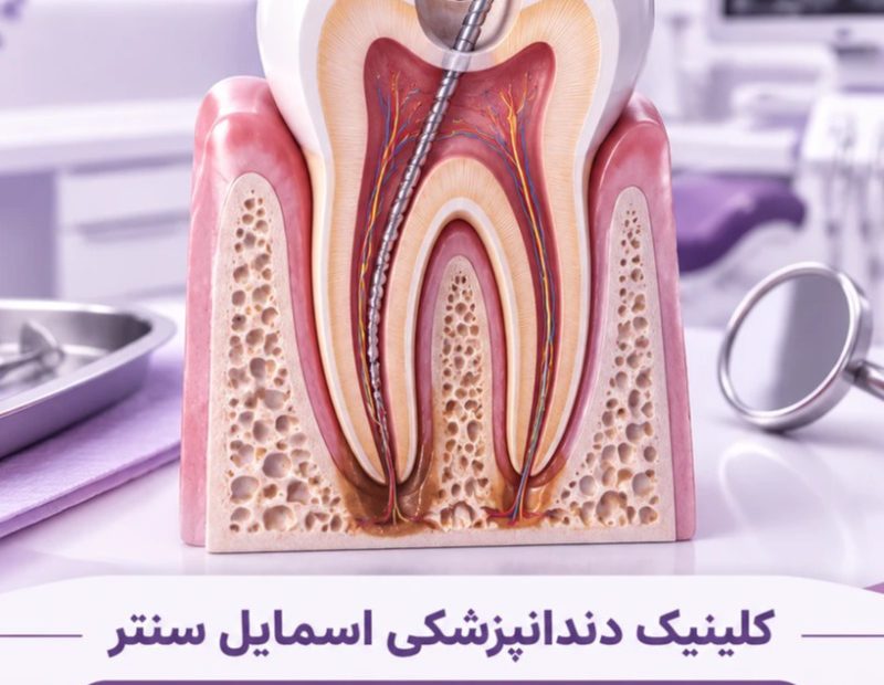 قیمت عصب کشی دندان
